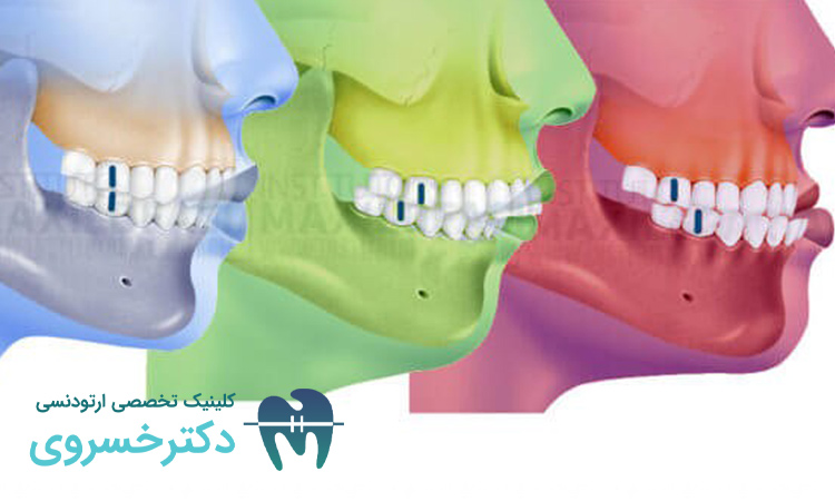 نقش ژنتیک در شکلگیری فک و دندانها