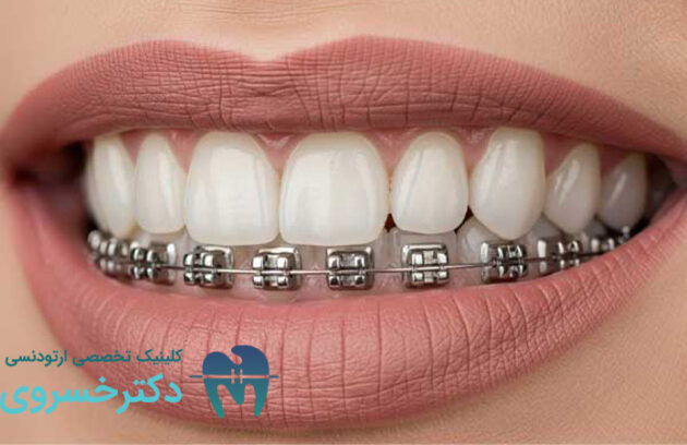 پرسیدن سوال از متخصص ارتودنسی