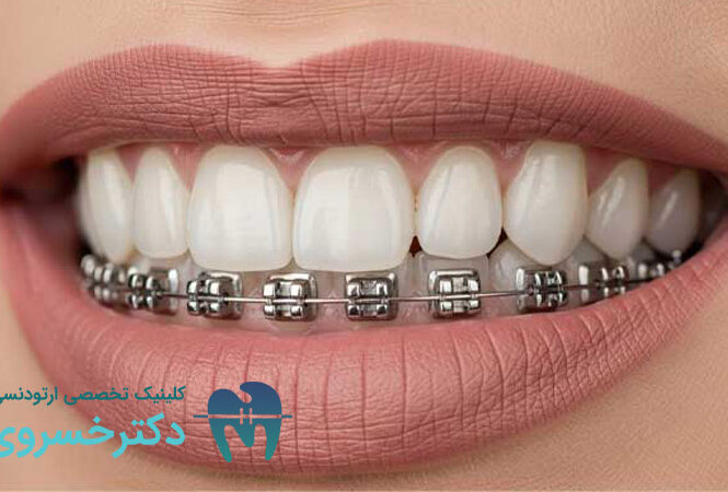پرسیدن سوال از متخصص ارتودنسی