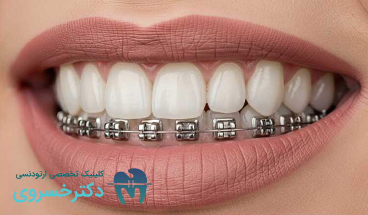 پرسیدن سوال از متخصص ارتودنسی