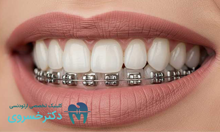 پرسیدن سوال از متخصص ارتودنسی