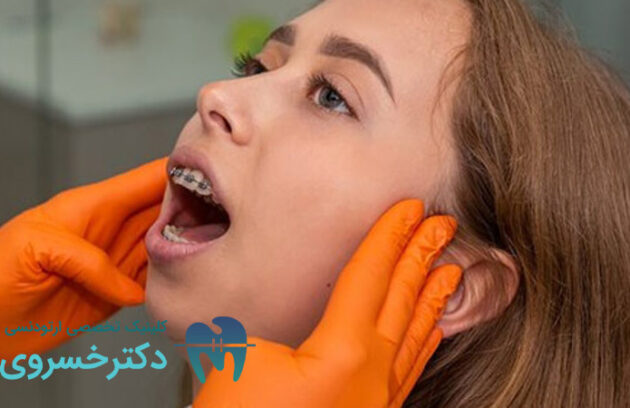معرفی عادات باعث تاخیر در درمان ارتودنسی