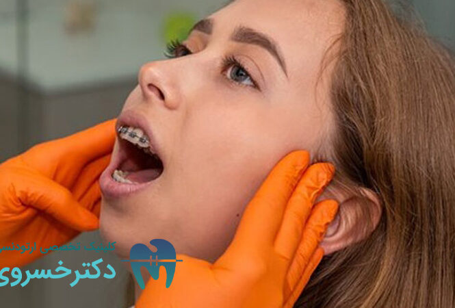معرفی عادات باعث تاخیر در درمان ارتودنسی