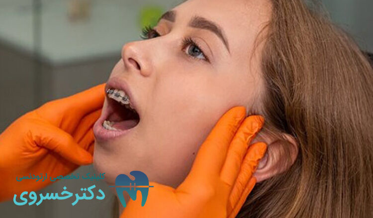معرفی عادات باعث تاخیر در درمان ارتودنسی