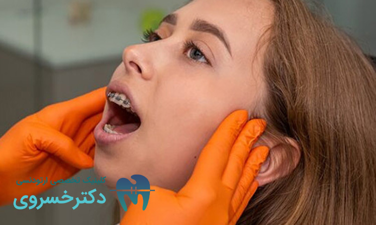 معرفی عادات باعث تاخیر در درمان ارتودنسی