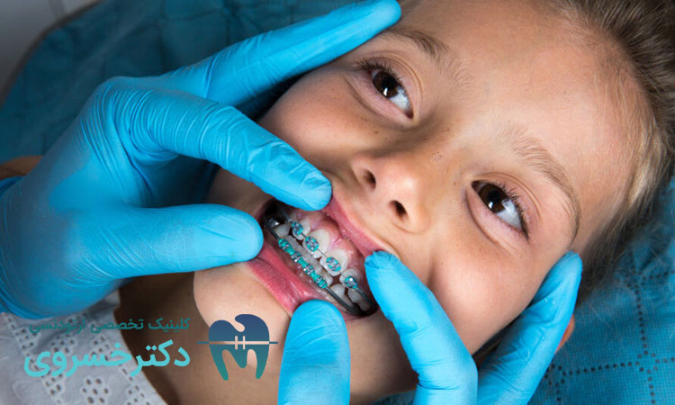 ۱۰ سوالی که باید از متخصص ارتودنسی خود بپرسید.