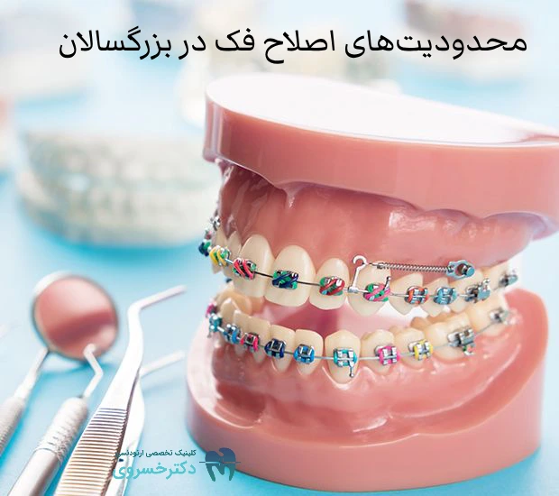 محدودیتهای اصلاح فک در بزرگسالان