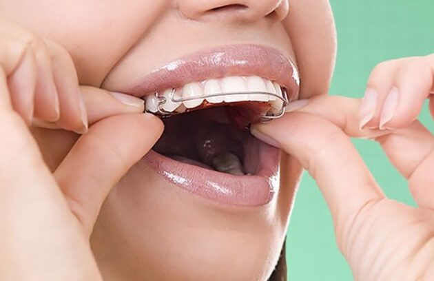 تأثیر ارتودنسی بر گفتار، جویدن و سلامت فک