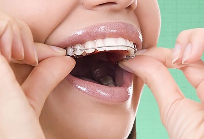 تأثیر ارتودنسی بر گفتار، جویدن و سلامت فک
