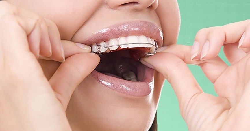 تأثیر ارتودنسی بر گفتار، جویدن و سلامت فک