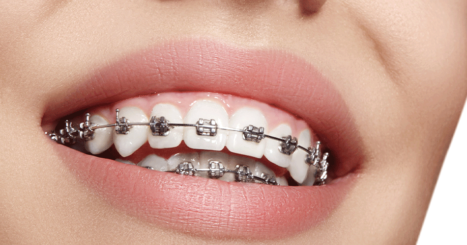 ارتباط بین مشکلات دندانی و التهاب مفصل فک