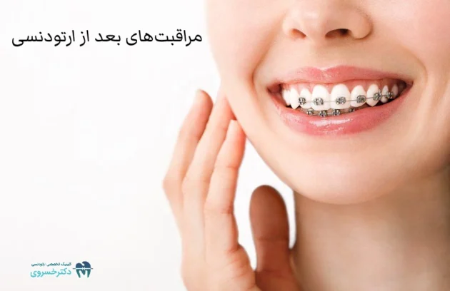 مراقبت های بعد از ارتودنسی