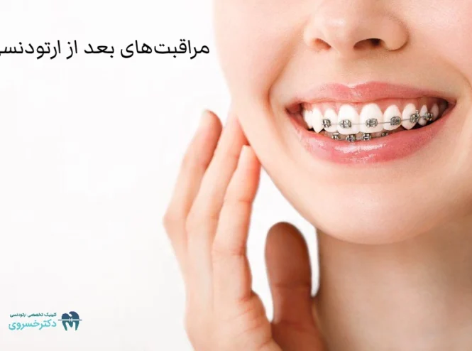 مراقبت های بعد از ارتودنسی