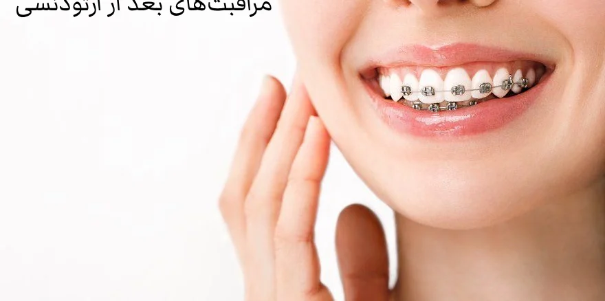 مراقبت های بعد از ارتودنسی