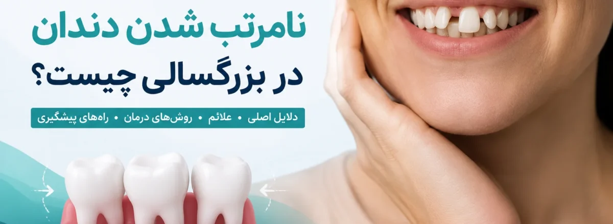علت نامرتب شدن دندان در بزرگسالی و جابهجایی دندانها