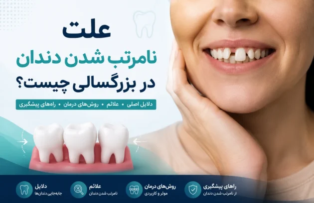 علت نامرتب شدن دندان در بزرگسالی و جابه‌جایی دندان‌ها