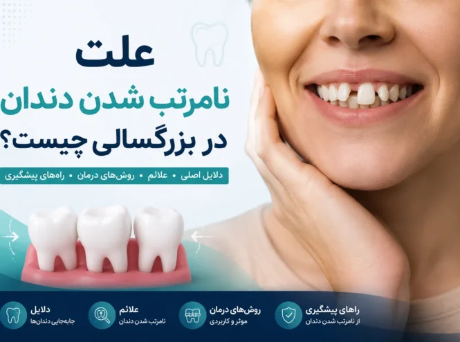 علت نامرتب شدن دندان در بزرگسالی و جابه‌جایی دندان‌ها