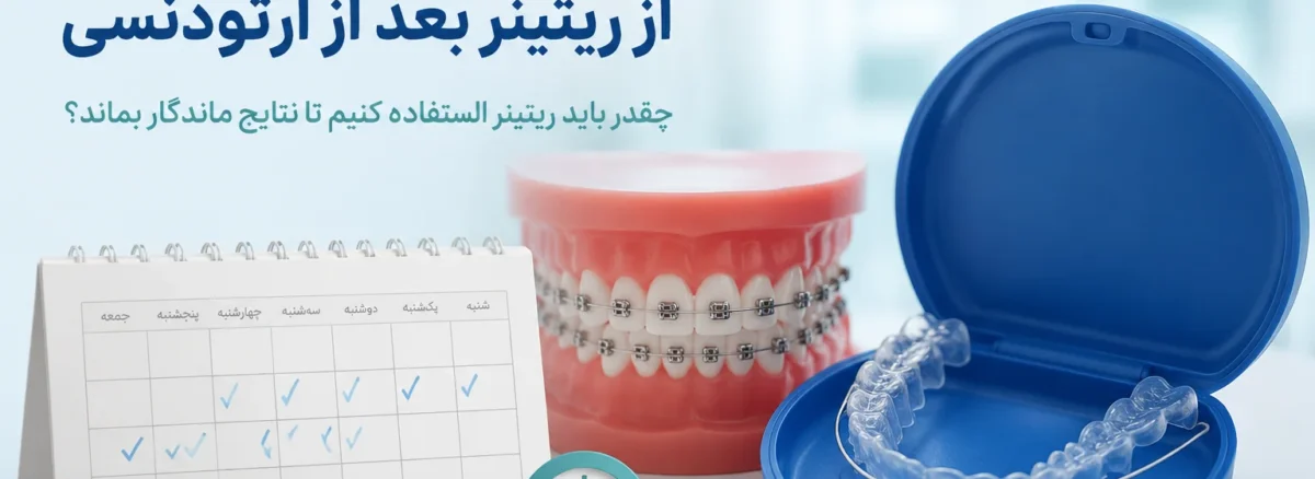مدت زمان استفاده از ریتینر بعد از ارتودنسی برای جلوگیری از بازگشت دندان‌ها