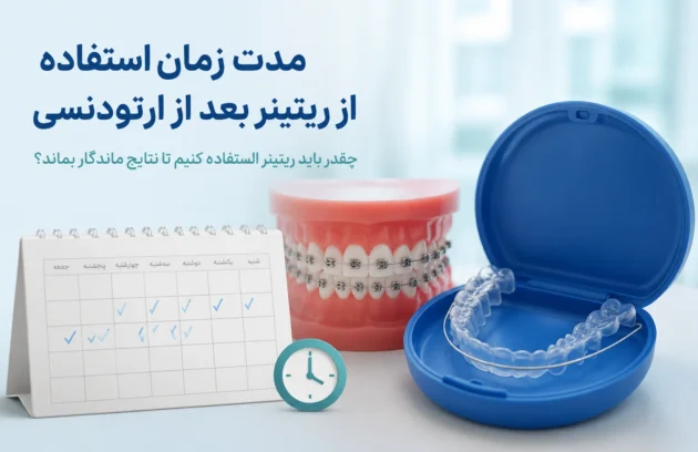 مدت زمان استفاده از ریتینر بعد از ارتودنسی برای جلوگیری از بازگشت دندان‌ها