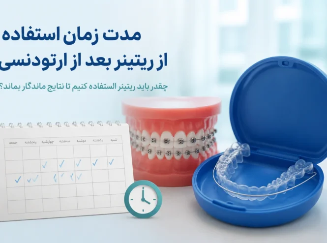 مدت زمان استفاده از ریتینر بعد از ارتودنسی برای جلوگیری از بازگشت دندان‌ها