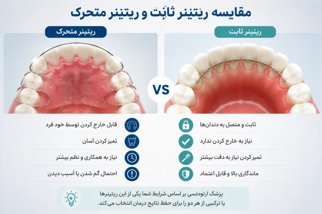 تفاوت ریتینر ثابت و متحرک بعد از ارتودنسی