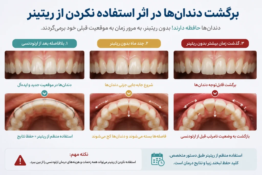 برگشت دندان‌ها در اثر استفاده نکردن از ریتینر