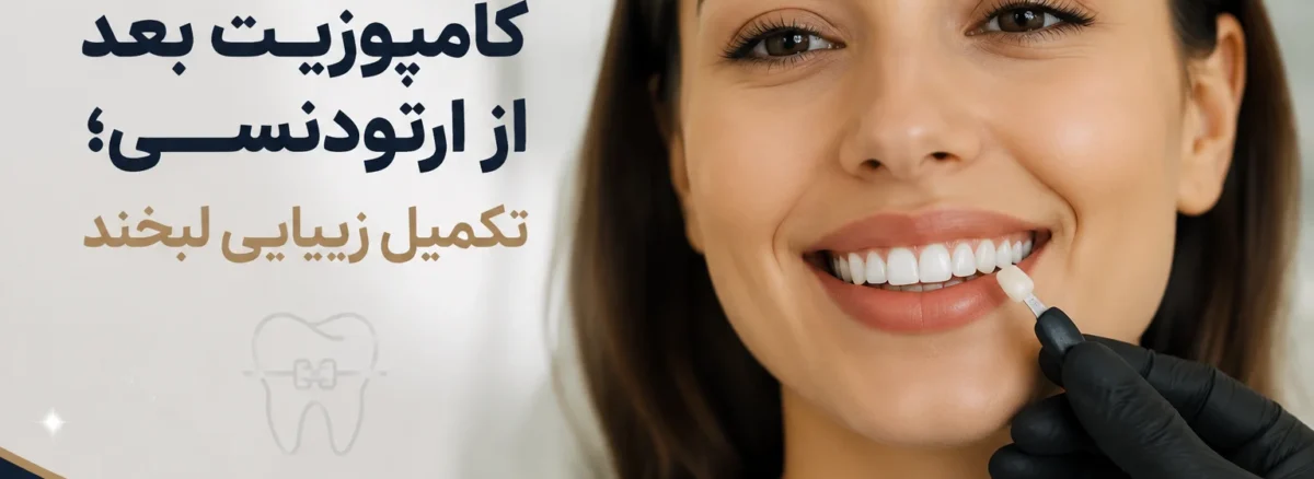 کامپوزیت بعد از ارتودنسی برای اصلاح فرم و زیبایی دندان‌ها