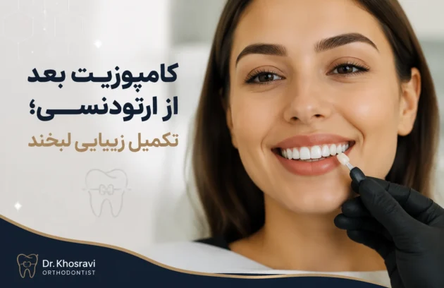 کامپوزیت بعد از ارتودنسی برای اصلاح فرم و زیبایی دندان‌ها