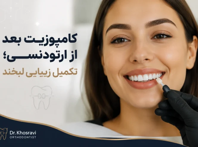 کامپوزیت بعد از ارتودنسی برای اصلاح فرم و زیبایی دندان‌ها