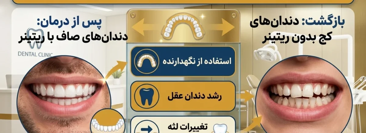 برگشت دندان بعد از ارتودنسی به دلیل استفاده نکردن از ریتینر
