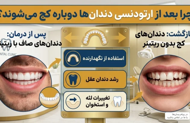 برگشت دندان بعد از ارتودنسی به دلیل استفاده نکردن از ریتینر