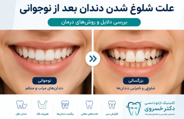 علت شلوغ شدن دندان بعد از نوجوانی و نامرتبی دندان در بزرگسالان