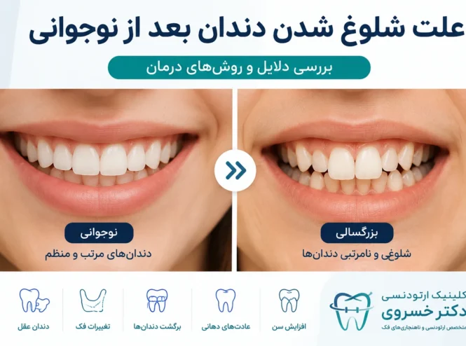 علت شلوغ شدن دندان بعد از نوجوانی و نامرتبی دندان در بزرگسالان