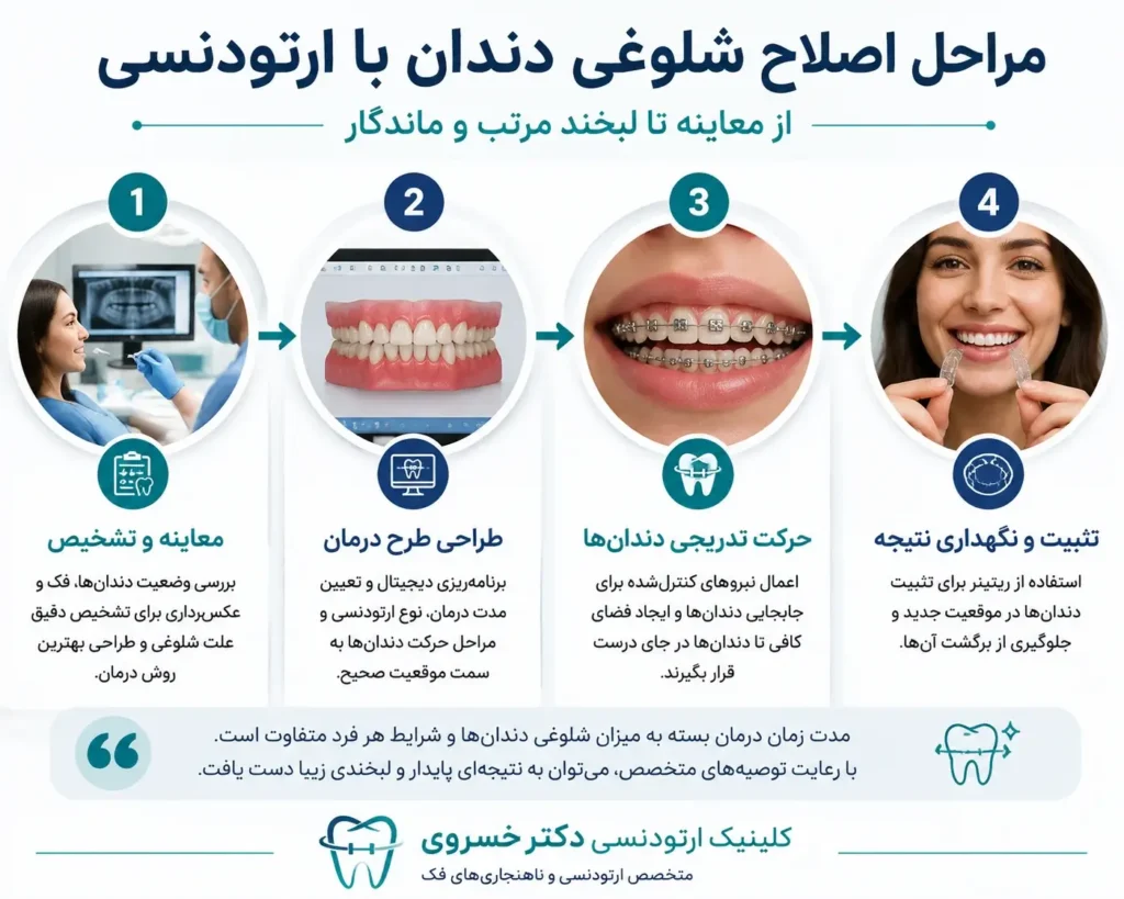 مراحل درمان شلوغ شدن دندان بعد از نوجوانی با ارتودنسی