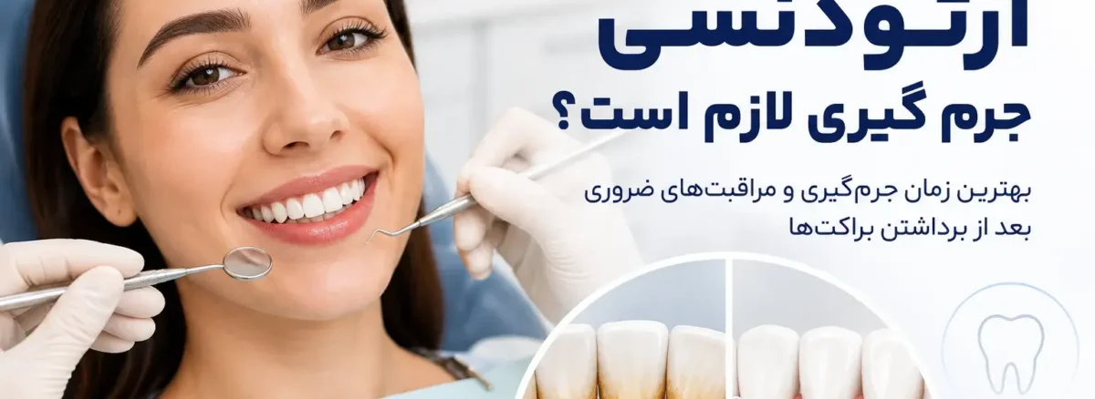آیا بعد از ارتودنسی جرم گیری لازم است و بهترین زمان انجام آن