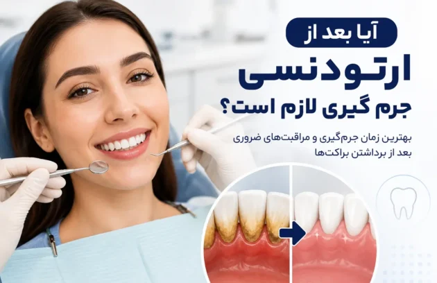 آیا بعد از ارتودنسی جرم گیری لازم است و بهترین زمان انجام آن