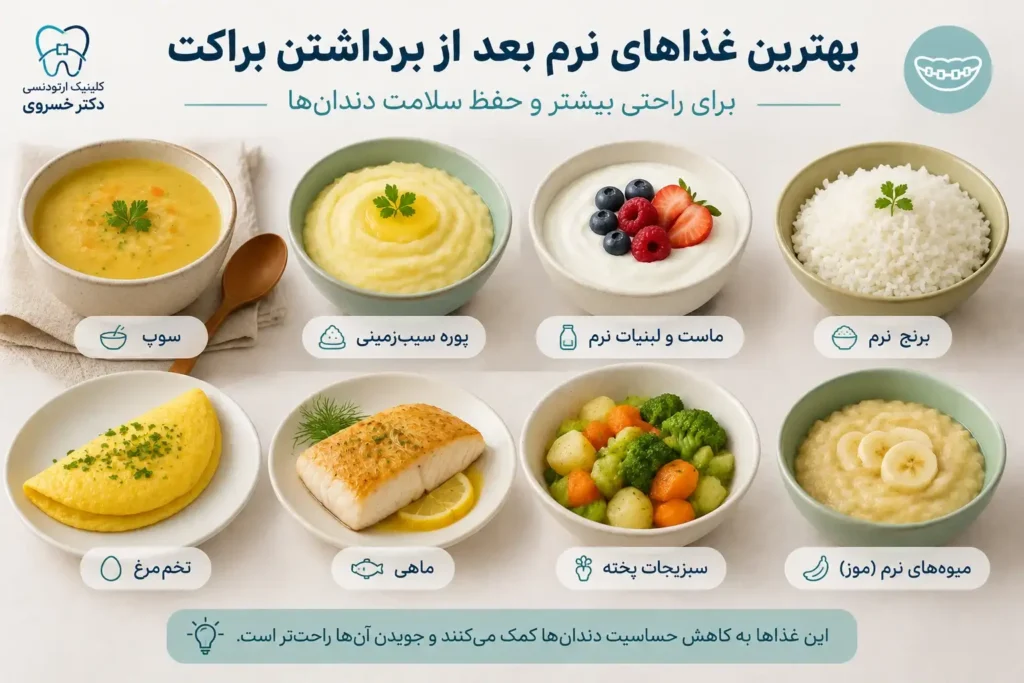 غذاهای نرم و مناسب بعد از برداشتن براکت ارتودنسی