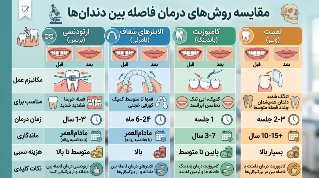 مقایسه ارتودنسی کامپوزیت و لمینت برای درمان فاصله بین دندانها