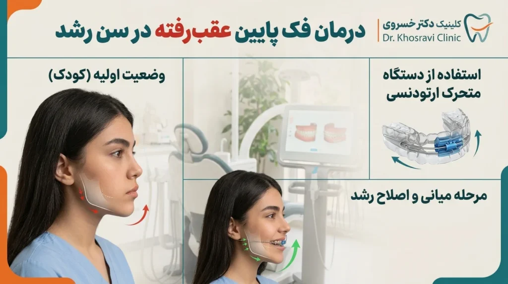 درمان عقب بودن فک پایین در سن رشد با ارتودنسی فانکشنال