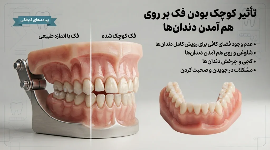 کوچک بودن فک یکی از علت های روی هم آمدن دندان ها