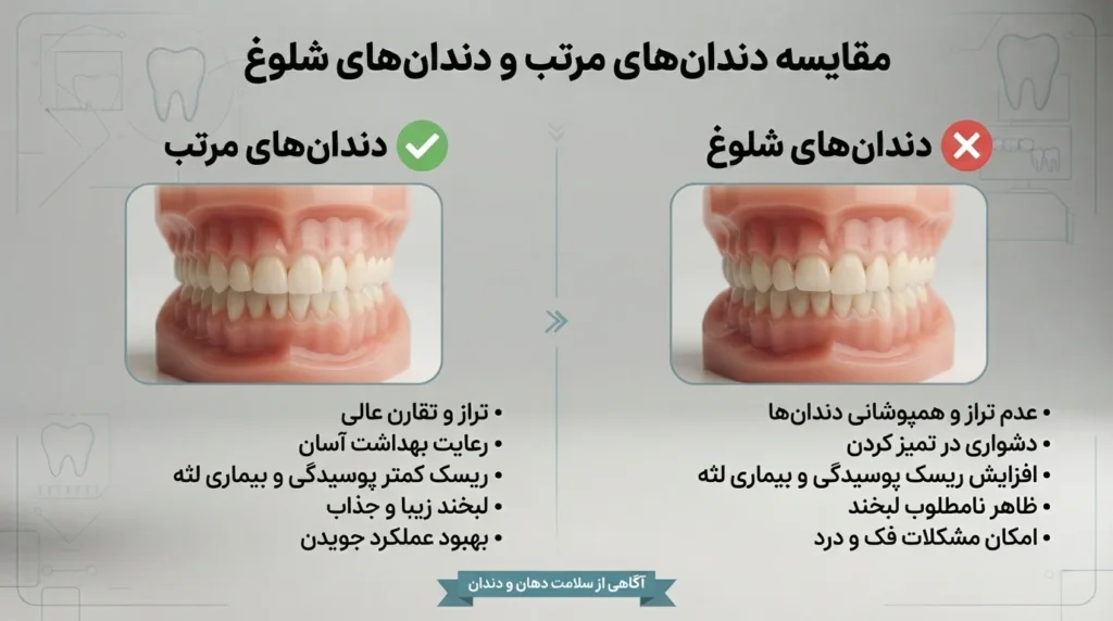 مقایسه دندان های مرتب با دندان های روی هم آمده