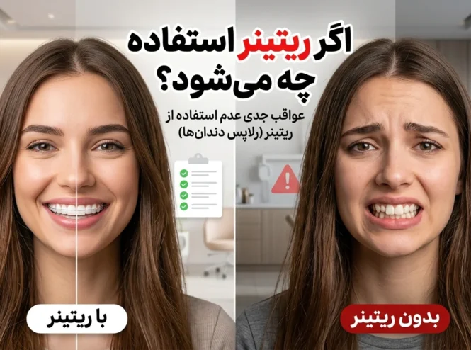 اگر ریتینر استفاده نکنیم چه می‌شود و آیا دندان‌ها بعد از ارتودنسی برمی‌گردند؟