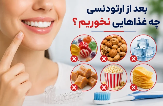 بعد از ارتودنسی چه غذاهایی نخوریم
