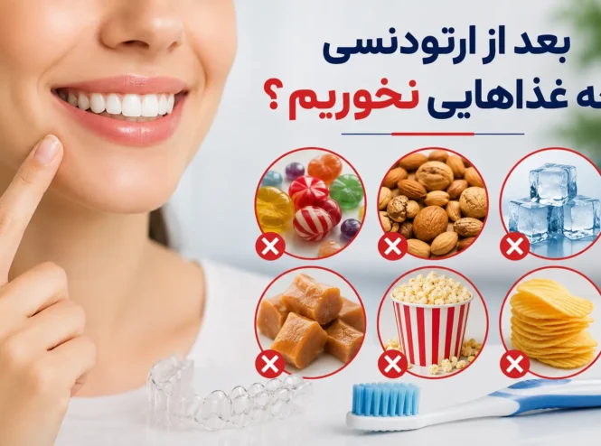 بعد از ارتودنسی چه غذاهایی نخوریم