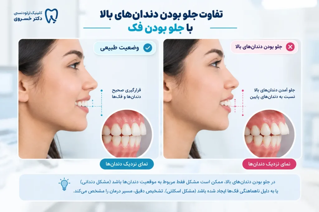 تفاوت جلو بودن دندان های بالا و جلو بودن فک