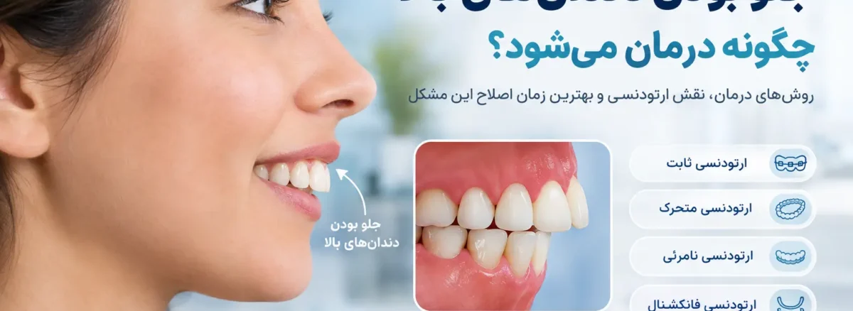 درمان جلو بودن دندان های بالا با ارتودنسی