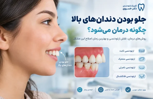 درمان جلو بودن دندان های بالا با ارتودنسی