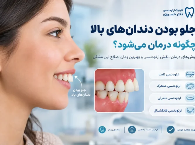 درمان جلو بودن دندان های بالا با ارتودنسی