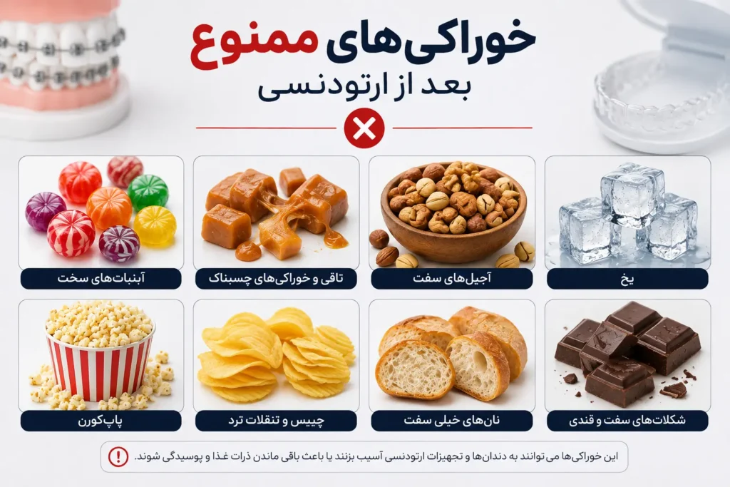خوراکیهای ممنوع بعد از ارتودنسی