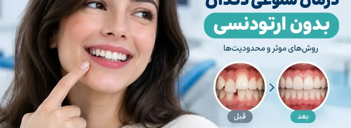 درمان شلوغی دندان بدون ارتودنسی و روش‌های اصلاح نامرتبی دندان
